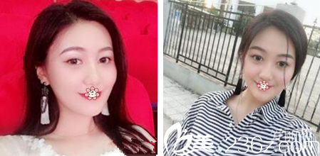 重慶好美整形雙眼皮怎么樣 重慶好美整形雙眼皮怎么樣