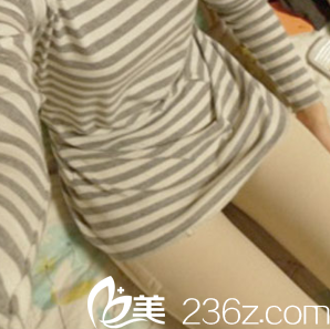 胡俊峰醫(yī)生給我做腿部吸脂第7天效果 胡俊峰醫(yī)生給我做腿部吸脂第7天效果