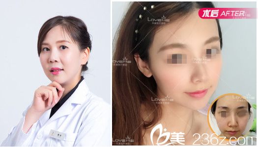 武漢樂美汪文娟面部線雕案例