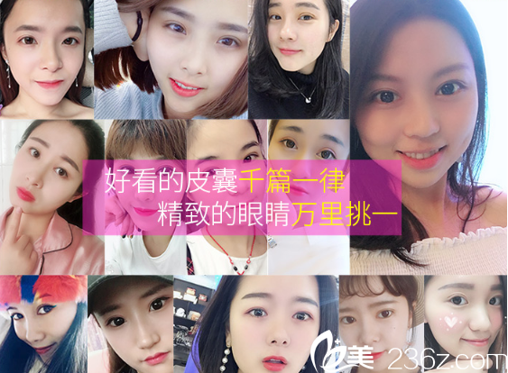 廣州美萊陳貴宗做的雙眼皮案例