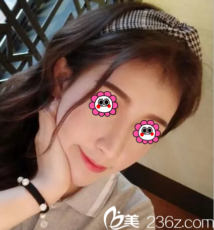 自體脂肪面部填充會有硬塊嗎？我在北京惠合嘉美塑美經(jīng)歷告訴你