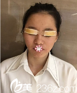 王靖院長給我做手術(shù)當(dāng)天 王靖院長給我做手術(shù)當(dāng)天