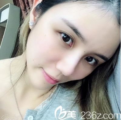 廣州哪家醫(yī)院做脂肪填充好 廣州哪家醫(yī)院做脂肪填充好