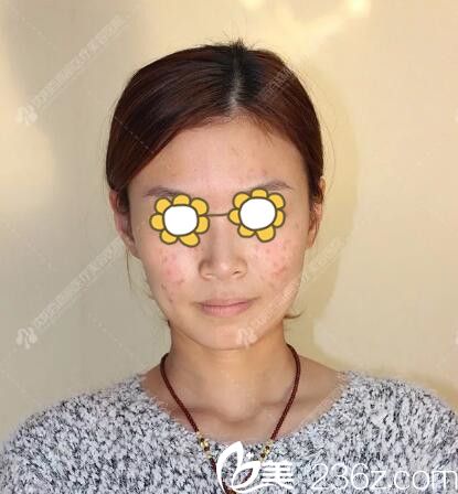 術(shù)前照片 術(shù)前照片