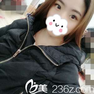 只是在株洲華美年華做了個切開雙眼皮+開內(nèi)眼角，沒想到就發(fā)生了這么大的變化