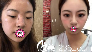 北京藝星眼綜合案例