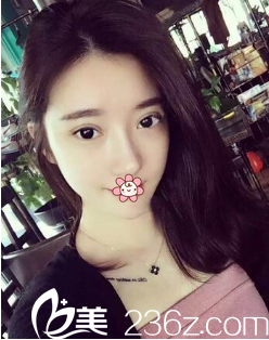 韓國GIO整形外科雙眼皮修復怎么樣 韓國GIO整形外科雙眼皮修復怎么樣