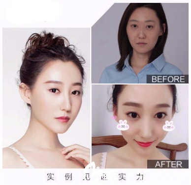 香港FMH醫(yī)學(xué)美容醫(yī)院治療案例