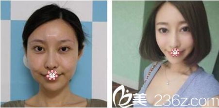 泰國KTOP整形<span style=