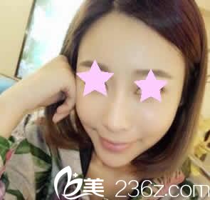 我在南寧華美做全臉埋線提升術(shù)后第2天照片