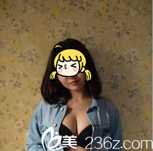 北京藝星<!--<i data=20240703-sp></i>-->自體脂肪豐胸<span style= 北京藝星<!--<i data=20240703-sp></i>-->自體脂肪豐胸<span style=