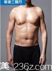 分享我在泰國(guó)KAMOL整形美容醫(yī)院的威塑4D吸脂經(jīng)歷，女友夸我男人味十足!