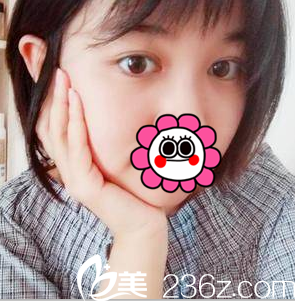 中國臺灣童顏醫(yī)療美容醫(yī)院切開雙眼皮案例 中國臺灣童顏醫(yī)療美容醫(yī)院切開雙眼皮案例