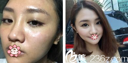 王祚軒院長案例 王祚軒院長案例