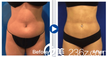 中國(guó)臺(tái)灣京媛體型雕塑案例