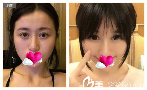 沈文示做的效果對比圖. 沈文示做的效果對比圖.