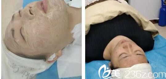 壹美尚整形微針美塑第88天恢復(fù)情況 壹美尚整形微針美塑第88天恢復(fù)情況