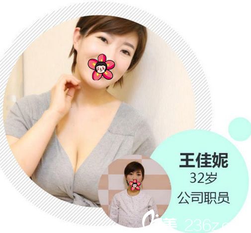 湖州尚麗胡承林假體隆胸案例 湖州尚麗胡承林假體隆胸案例