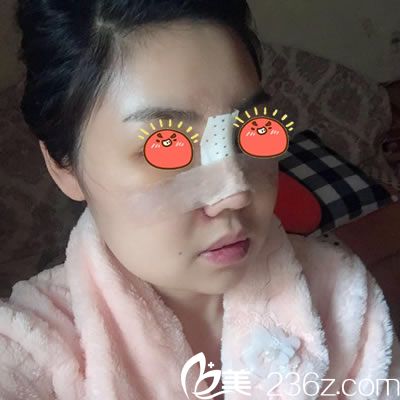 在寧波雅韓剛做完隆鼻手術(shù)照片