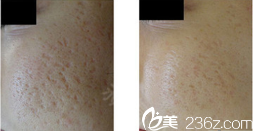 日本Ta’s Clinic新宿本多剛大相關(guān)案例