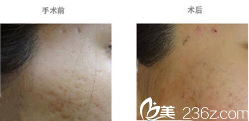 日本Ta’s Clinic新宿本多剛大相關(guān)案例