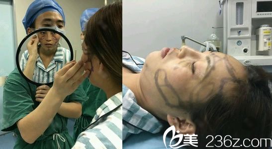 寧波雅韓劉成林設(shè)計脂肪填充方案