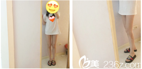 廣州韓妃于洪瑞做吸脂怎么樣