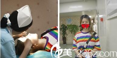 術(shù)后7天到院拆線復(fù)查