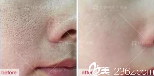 ?？诩t妝尚美顏肌真人前后效果展示