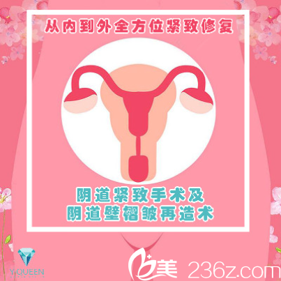 陰道緊致手術(shù)及陰道壁褶皺再造術(shù) 陰道緊致手術(shù)及陰道壁褶皺再造術(shù)