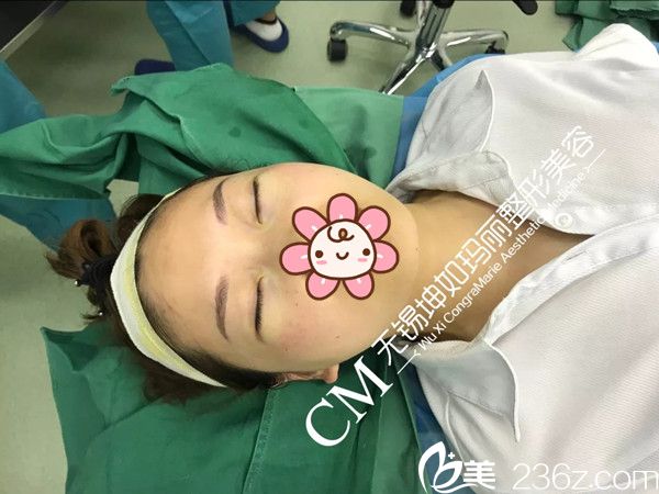 剛做完無痕祛眼袋術(shù)后即刻效果