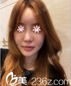 術前的我 術前的我