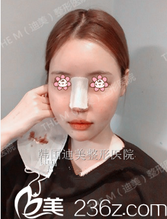 做完手術當天 做完手術當天