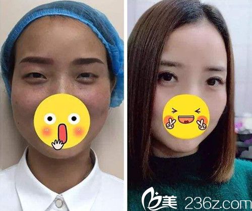 邯鄲京美2019新年整形優(yōu)惠價(jià)格表已上線 雙眼皮僅680元