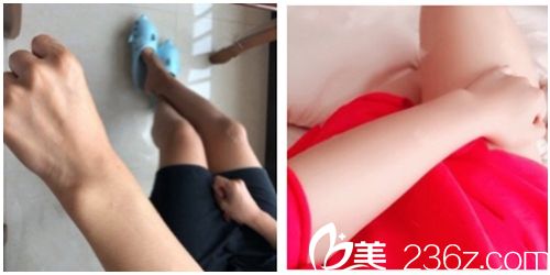 泰國TARA CLINIC整形醫(yī)院案例