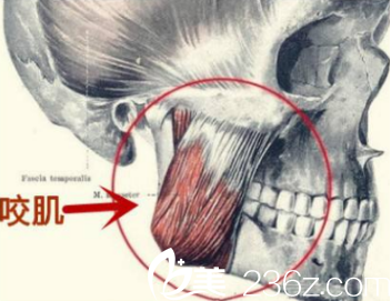 咬肌的示意圖