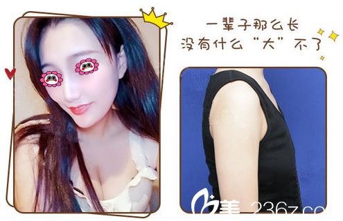 嘉興曙光整形高俊隆胸變化圖