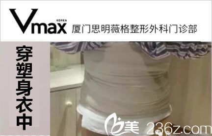 做完腰腹吸脂穿塑身衣的照片 做完腰腹吸脂穿塑身衣的照片