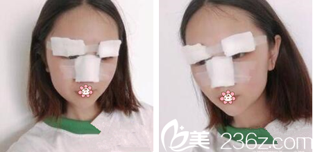 我做手術(shù)當(dāng)天 我做手術(shù)當(dāng)天