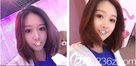 兩個(gè)月效果 兩個(gè)月效果