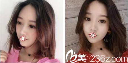 泰國(guó)然禧Yanhee整形醫(yī)院怎么樣 泰國(guó)然禧Yanhee整形醫(yī)院怎么樣