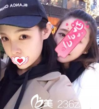 將我在石家莊藍(lán)山做鼻綜合手術(shù)1個(gè)月恢復(fù)過(guò)程圖分享給大家 只想說(shuō)選盧闖醫(yī)生做隆鼻是真靠譜