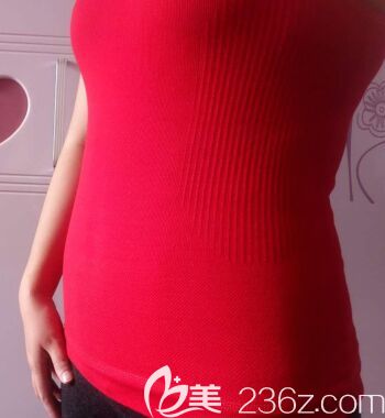 我在太原歐美蓮做360水動(dòng)力腰腹部吸脂第10天