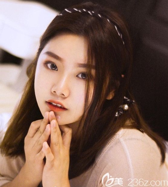 合肥壹加壹整形面部抽脂術(shù)后第18天 合肥壹加壹整形面部抽脂術(shù)后第18天