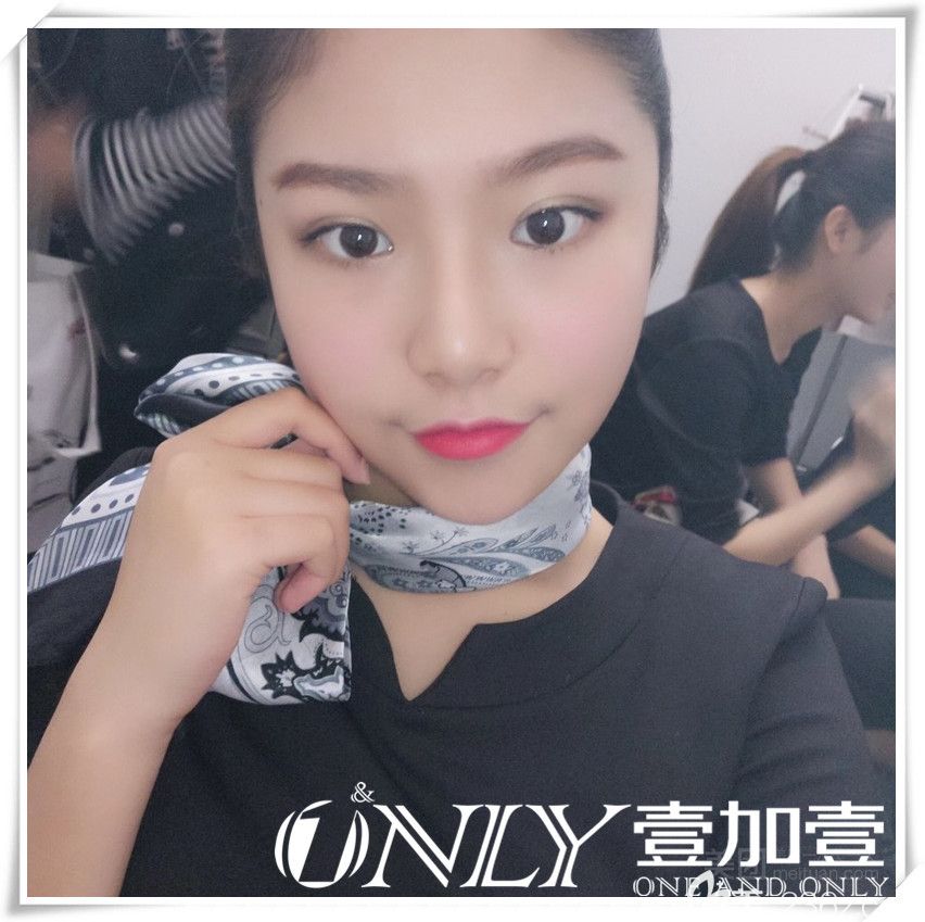 壹加壹整形面部吸脂術(shù)后第29天恢復(fù)情況 壹加壹整形面部吸脂術(shù)后第29天恢復(fù)情況