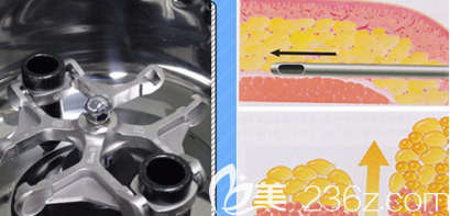 淄博美聯(lián)臣自體脂肪移植吸取脂肪示意圖 淄博美聯(lián)臣自體脂肪移植吸取脂肪示意圖