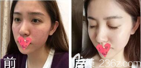 貴陽美貝爾案例