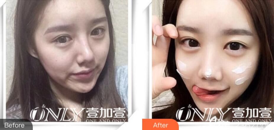 壹加壹楊義效果圖前后對比案例 壹加壹楊義效果圖前后對比案例