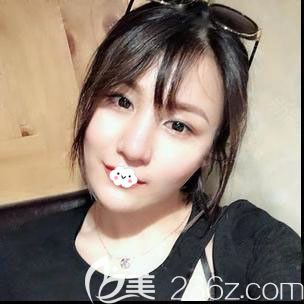 武漢做鼻修復哪家醫(yī)院的醫(yī)生好？我找時光整形包濤鼻綜合隆鼻修復失敗丑鼻