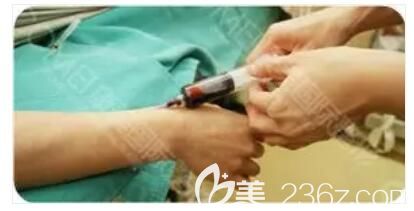 自體脂肪豐胸術(shù)前進(jìn)行常規(guī)身體檢查 自體脂肪豐胸術(shù)前進(jìn)行常規(guī)身體檢查